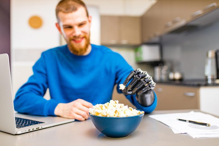 Day To Day Living Disability - Man with prosthetic arm eating popcorn